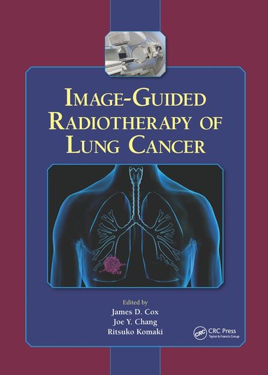 bokomslag Image-Guided Radiotherapy of Lung Cancer