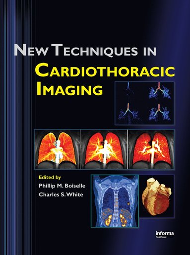 bokomslag New Techniques in Cardiothoracic Imaging