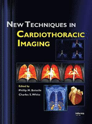 New Techniques in Cardiothoracic Imaging 1