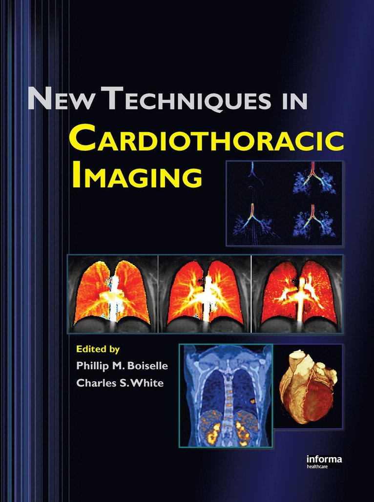 Phillip M. Boiselle, Charles S. White - New Techniques in Cardiothoracic Imaging, Inbunden