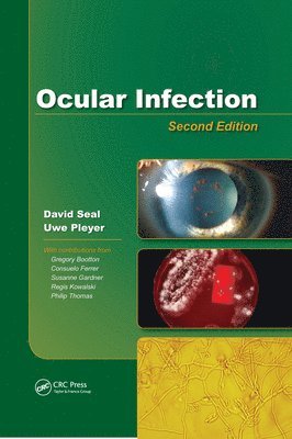 Ocular Infection 1