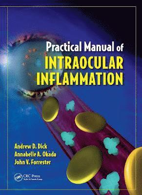 Practical Manual of Intraocular Inflammation