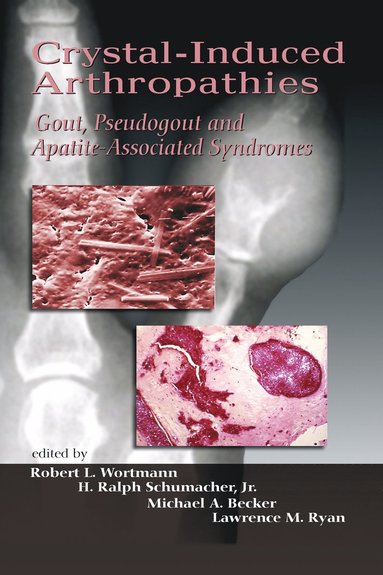 bokomslag Crystal-Induced Arthropathies