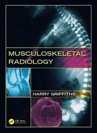bokomslag Musculoskeletal Radiology
