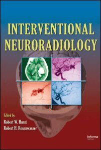 Robert W. Hurst, Robert H. Rosenwasser - Interventional Neuroradiology, Inbunden
