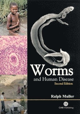 Ralph Muller - Worms and Human Disease, Häftad