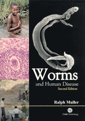 Worms and Human Disease 1