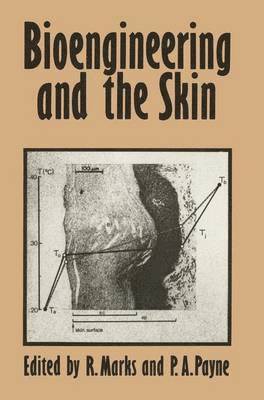 R. Marks - Bioengineering and the Skin, Inbunden