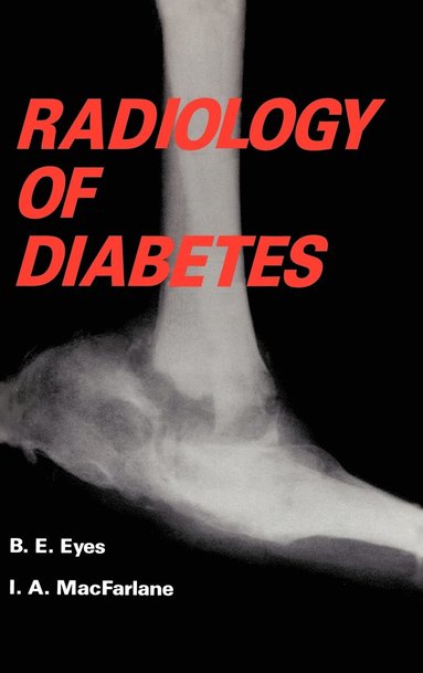 bokomslag Radiology of Diabetes