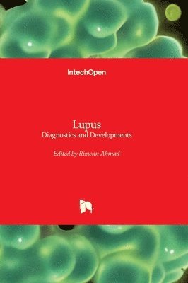 Rizwan Ahmad - Lupus, Inbunden