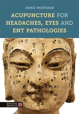 Acupuncture for Headaches, Eyes and ENT Pathologies 1