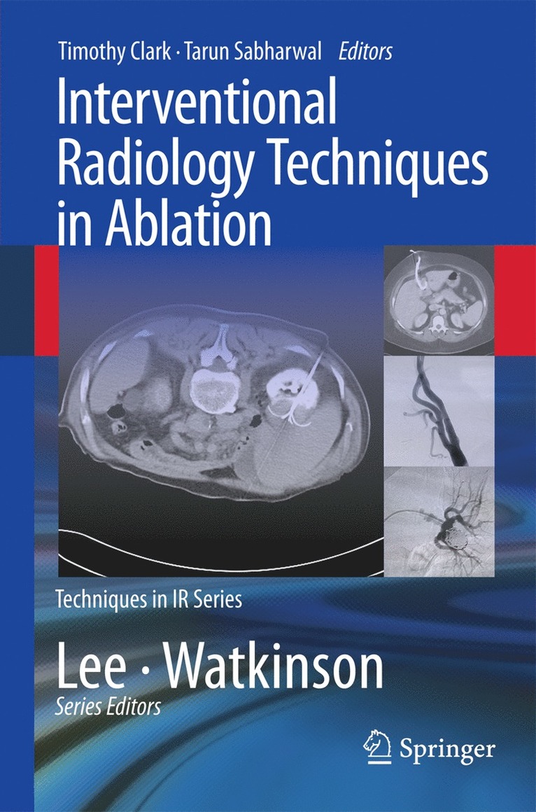 Interventional Radiology Techniques in Ablation 1