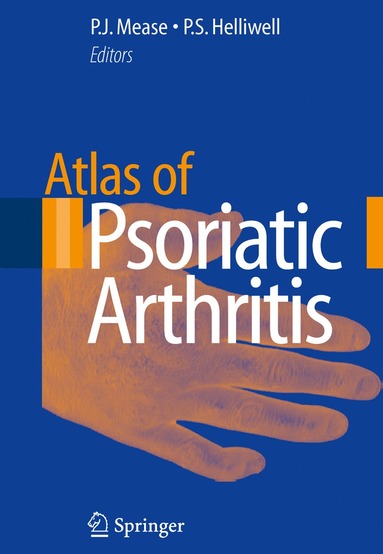 bokomslag Atlas of Psoriatic Arthritis