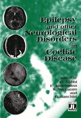 G Gobbi, F Andermann, S Naccarato, G Banchini - Epilepsy & Other Neurological Disorders in Coeliac Disease, Häftad