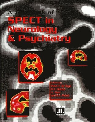 Textbook of SPECT in Neurology & Psychiatry 1