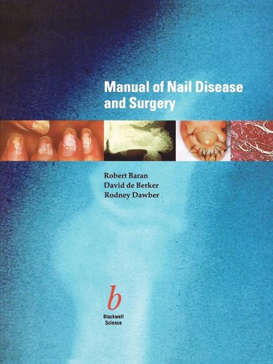 Robert Baran, David A. R. de Berker, Rodney Dawber - Manual of Nail Disease and Surgery, Häftad