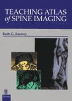 Ruth G. Ramsey - Teaching Atlas of Spine Imaging, Inbunden
