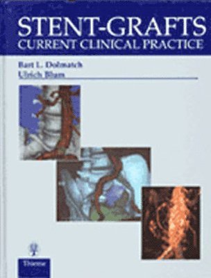 Bart L. Dolmatch, Ulrich Blum - Stent-Grafts: Current Clinical Practice, Inbunden