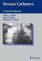 Philip C. Pieters, Jaime Tisnado - Venous Catheters: A Practical Manual, Inbunden
