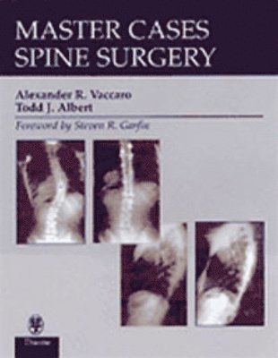 Alexander R. Vaccaro, Todd J. Albert - Mastercases in Spine Surgery, Inbunden