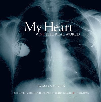 My Heart Vs. the Real World 1