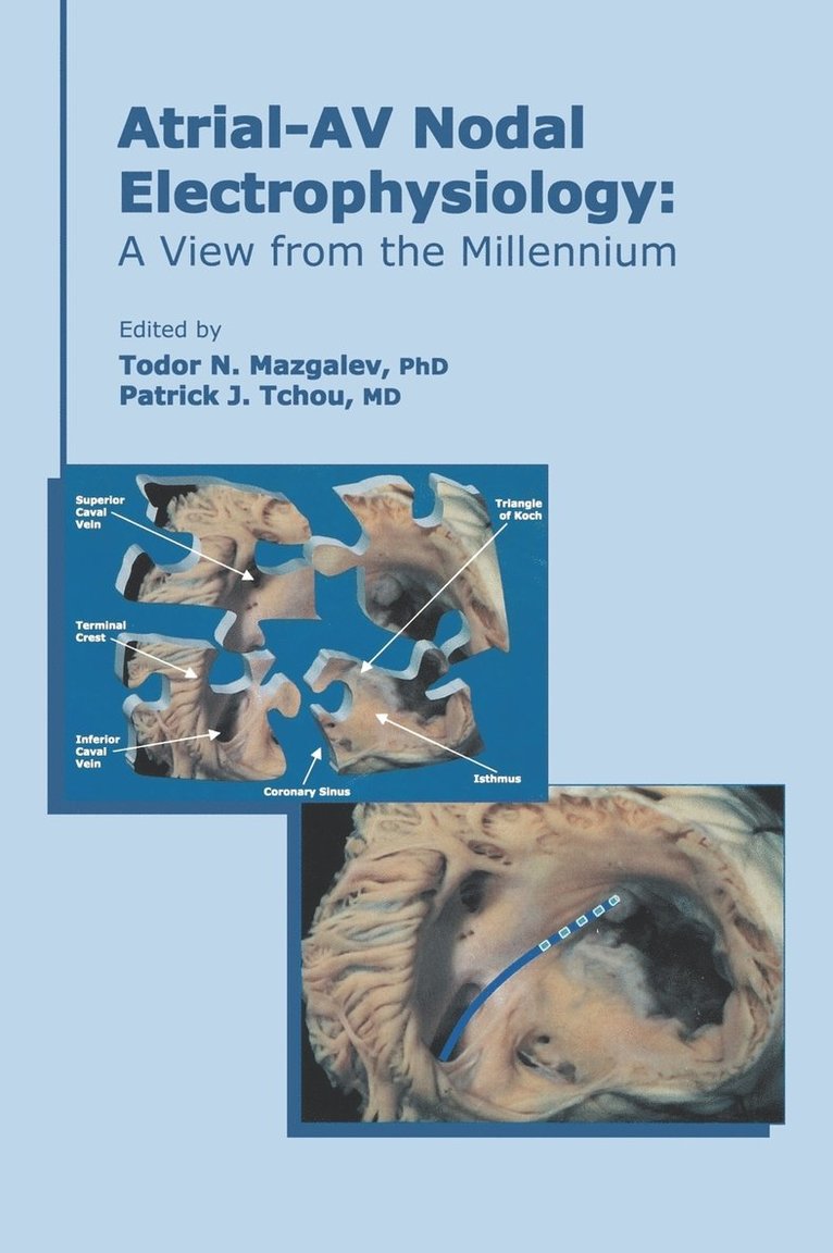 Mazgalev, Tchou, Todor N. Mazgalev, Patrick J. Tchou, USA) Mazgalev, Todor N. (The Cleveland Clinic Foundation, Cleveland, OH, OH) Tchou, Patrick J. (Head of Electrophysiology, The Cleveland Clinic Foundation, Cleveland, Todor N Mazgalev, Patrick J Tchou - Atrial-AV Nodal Electrophysiology, Inbunden