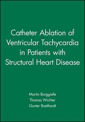 bokomslag Catheter Ablation of Ventricular Tachycardia in Patients with Structural Heart Disease
