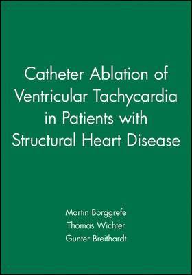 Catheter Ablation of Ventricular Tachycardia in Patients with Structural Heart Disease