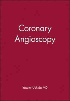 bokomslag Coronary Angioscopy