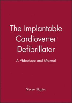 The Implantable Cardioverter Defibrillator 1