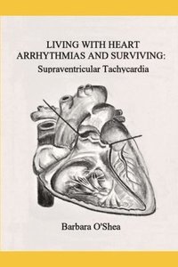 bokomslag Living with Heart Arrhythmias and Surviving: Supraventricular Tachycardia