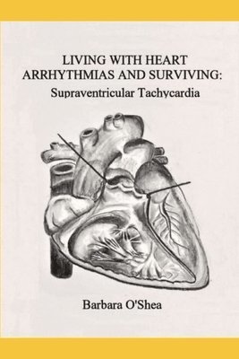 Living with Heart Arrhythmias and Surviving: Supraventricular Tachycardia 1