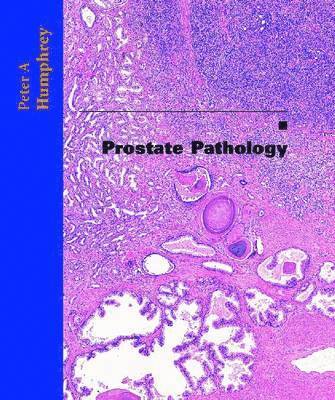 Prostate Pathology 1