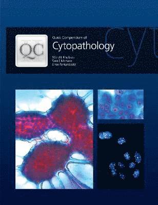 Walid E. Khalbuss, Sara E. Monaco, Liron Pantanowitz - Quick Compendium of Cytopathology, Inbunden