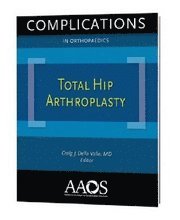 Total Hip Arthroplasty