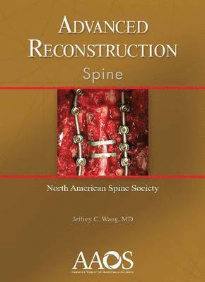 Advanced Reconstruction: Spine