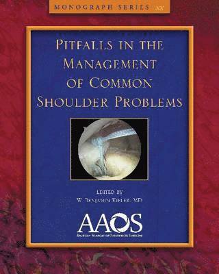 Pitfalls in the Management of Common Shoulder Problems