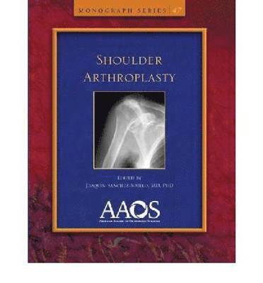 Joaquin Sanchez-Sotelo - Shoulder Arthroplasty, Häftad