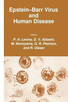 bokomslag Epstein-Barr Virus and Human Disease