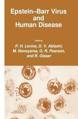 Epstein-Barr Virus and Human Disease 1
