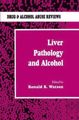 Roland R. Watson, Ronald Watson, Roland R Watson - Liver Pathology and Alcohol: Drug & Alcohol Abuse Reviews, Inbunden