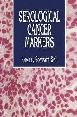 Serological Cancer Markers 1