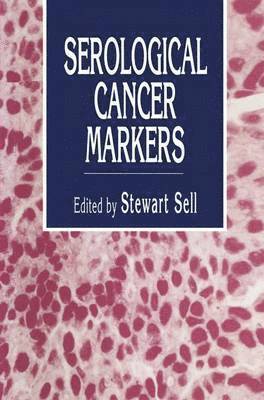 Stewart Sell - Serological Cancer Markers, Inbunden