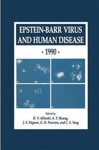 bokomslag Epstein-Barr Virus and Human Disease * 1990