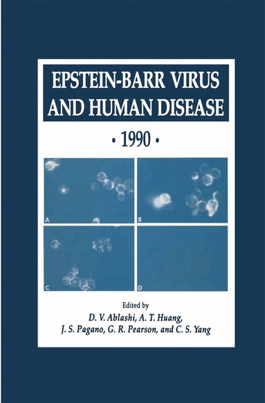 D. V. Ablashi, A. T. Huang, J. S. Pagano, G. R. Pearson, C. S. Yang - Epstein-Barr Virus and Human Disease · 1990, Inbunden