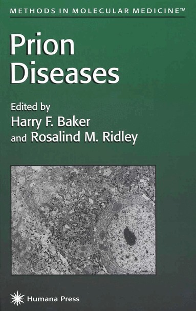 Harry F. Baker, Rosalind M. Ridley - Prion Diseases, Inbunden
