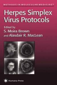 bokomslag Herpes Simplex Virus Protocols