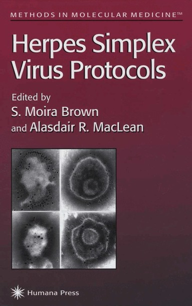 S. Moira Brown, Alasdair R. MacLean - Herpes Simplex Virus Protocols, Inbunden