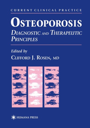 Clifford J. Rosen - Osteoporosis, Inbunden