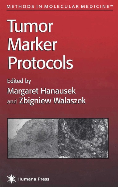 Margaret Hanausek, Zbigniew Walaszek - Tumor Marker Protocols, Inbunden
